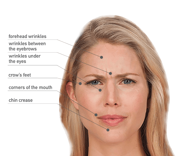 Wrinkle reduction