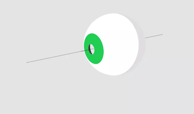 INTRASTROMAL CORNEAL RINGS