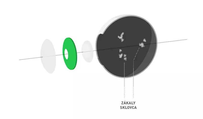 Zakaly sklovca