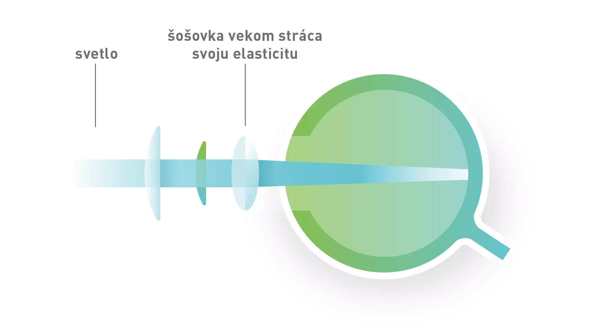 Starecká ďalekozrakosť