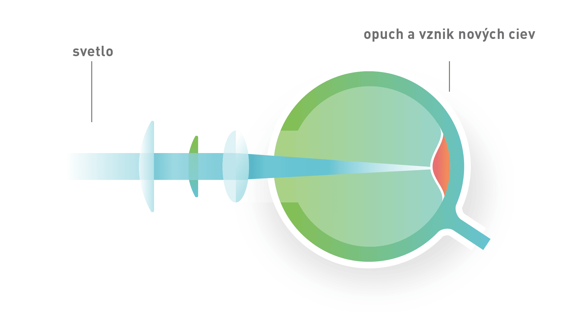 Zlta skvrna