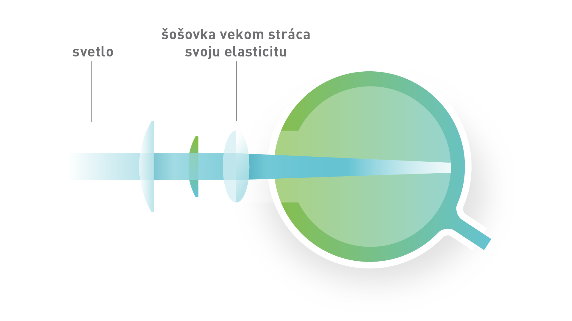 Starecká ďalekozrakosť