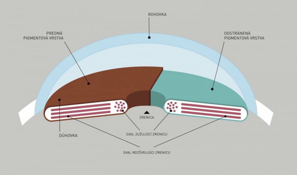 Farba očí závisí od farby dúhovky. Farbu dúhovky určuje množstvo a umiestnenie pigmentu. Pigment umiestnený iba v hĺbke presvitá cez tkanivo dúhovky a farba dúhovky sa vtedy javí  ako modrá.